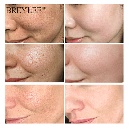 BREYLEE® Hyaluron Tiefenpflege